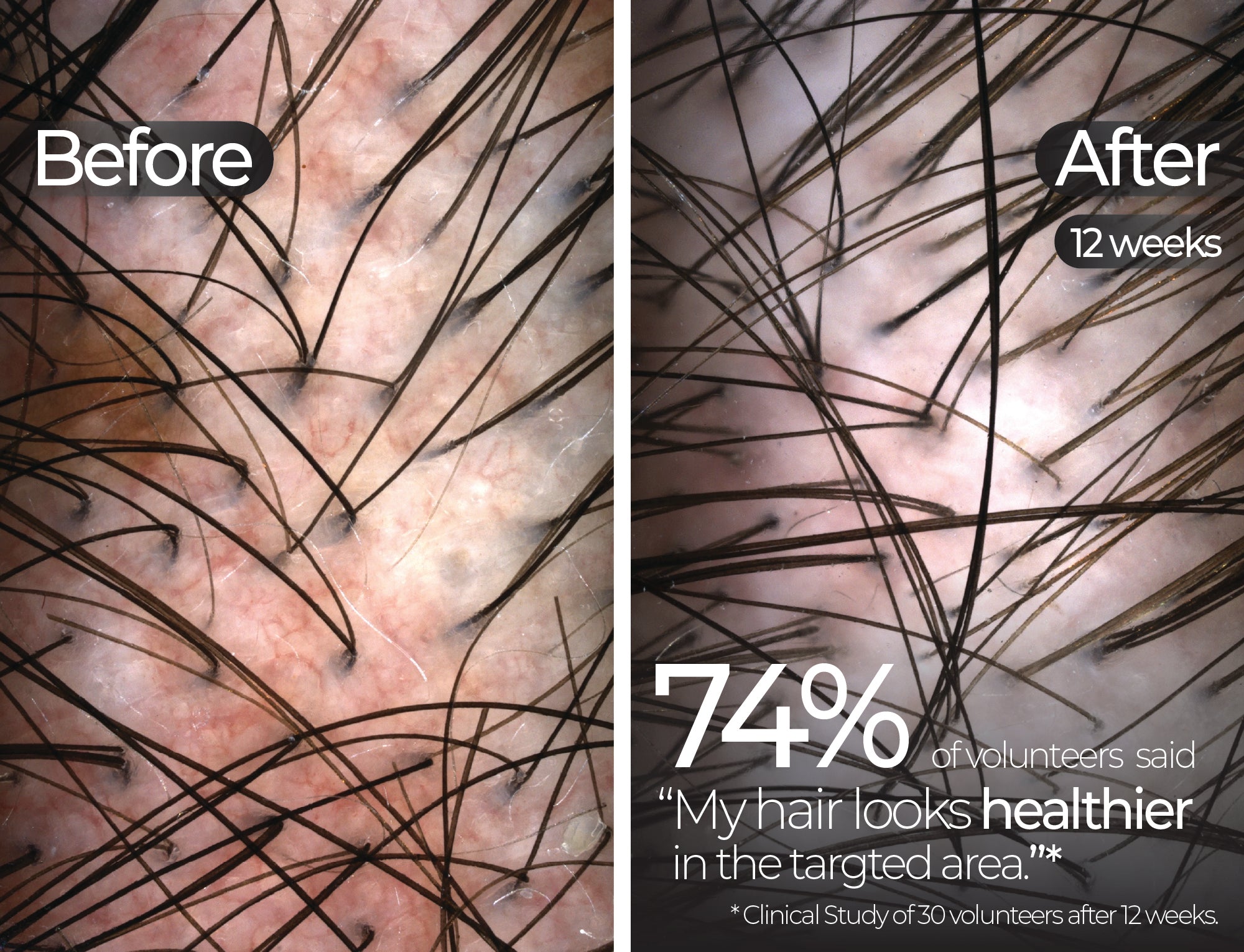 Before & After slide 1