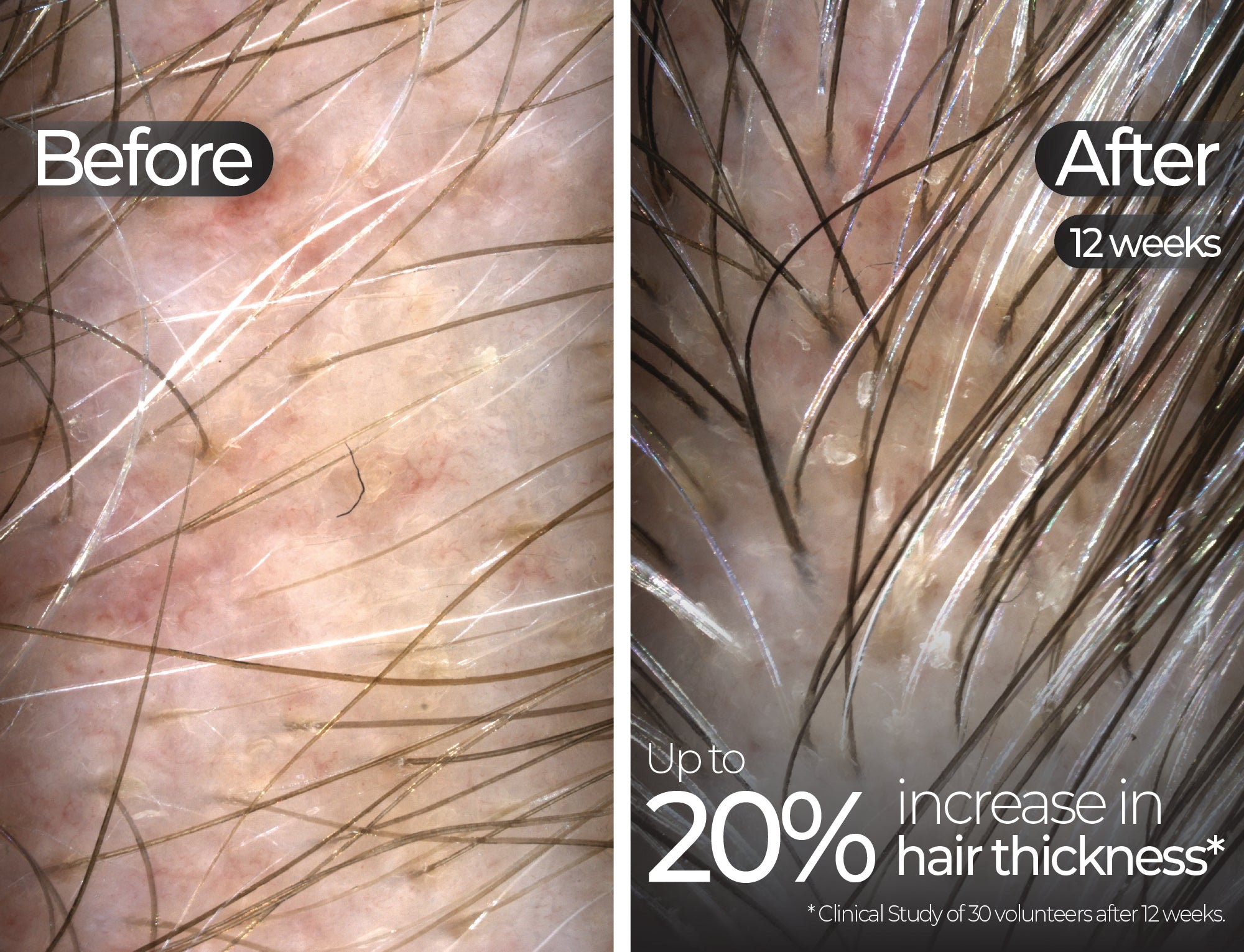 Before & After slide 3