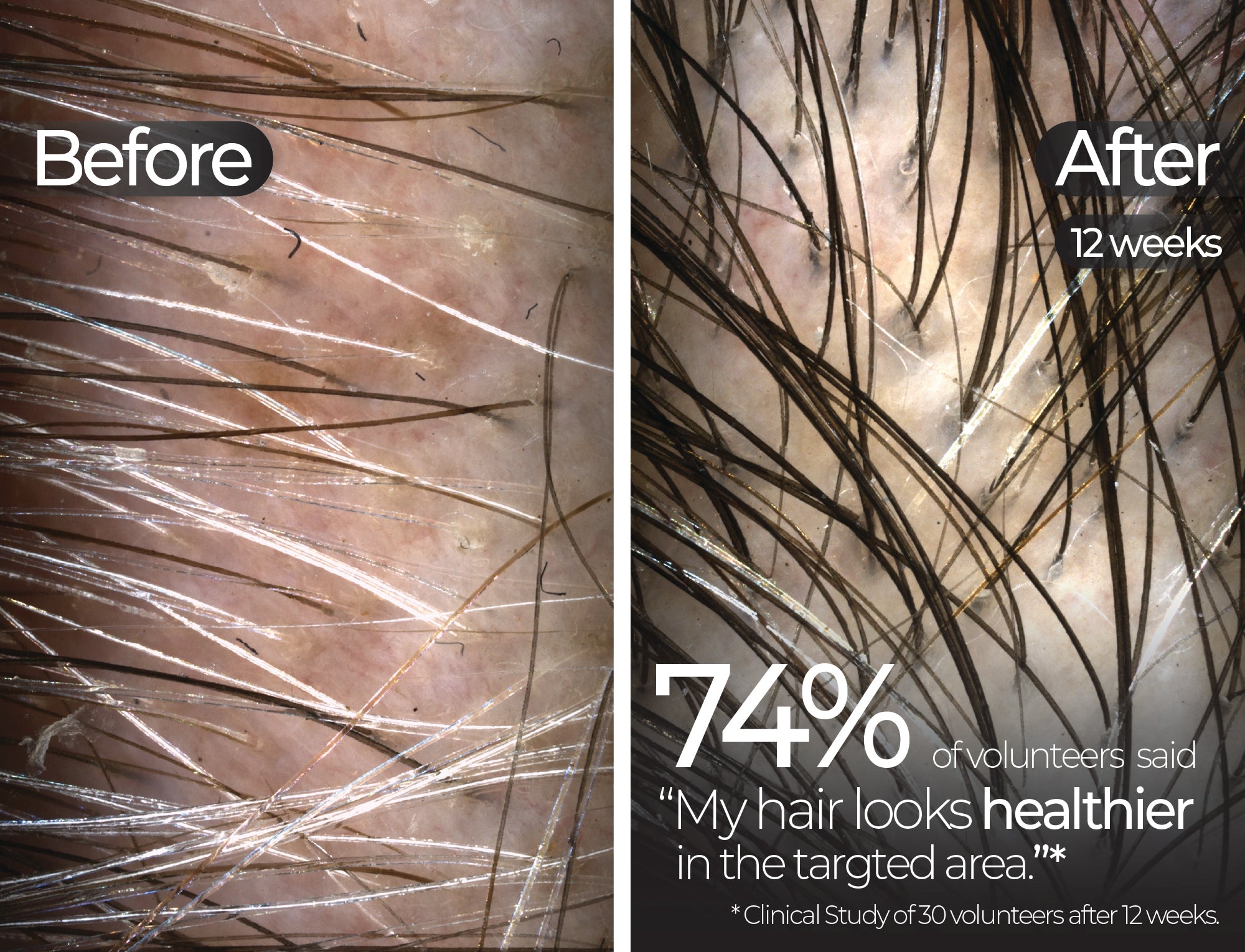 Before & After slide 4