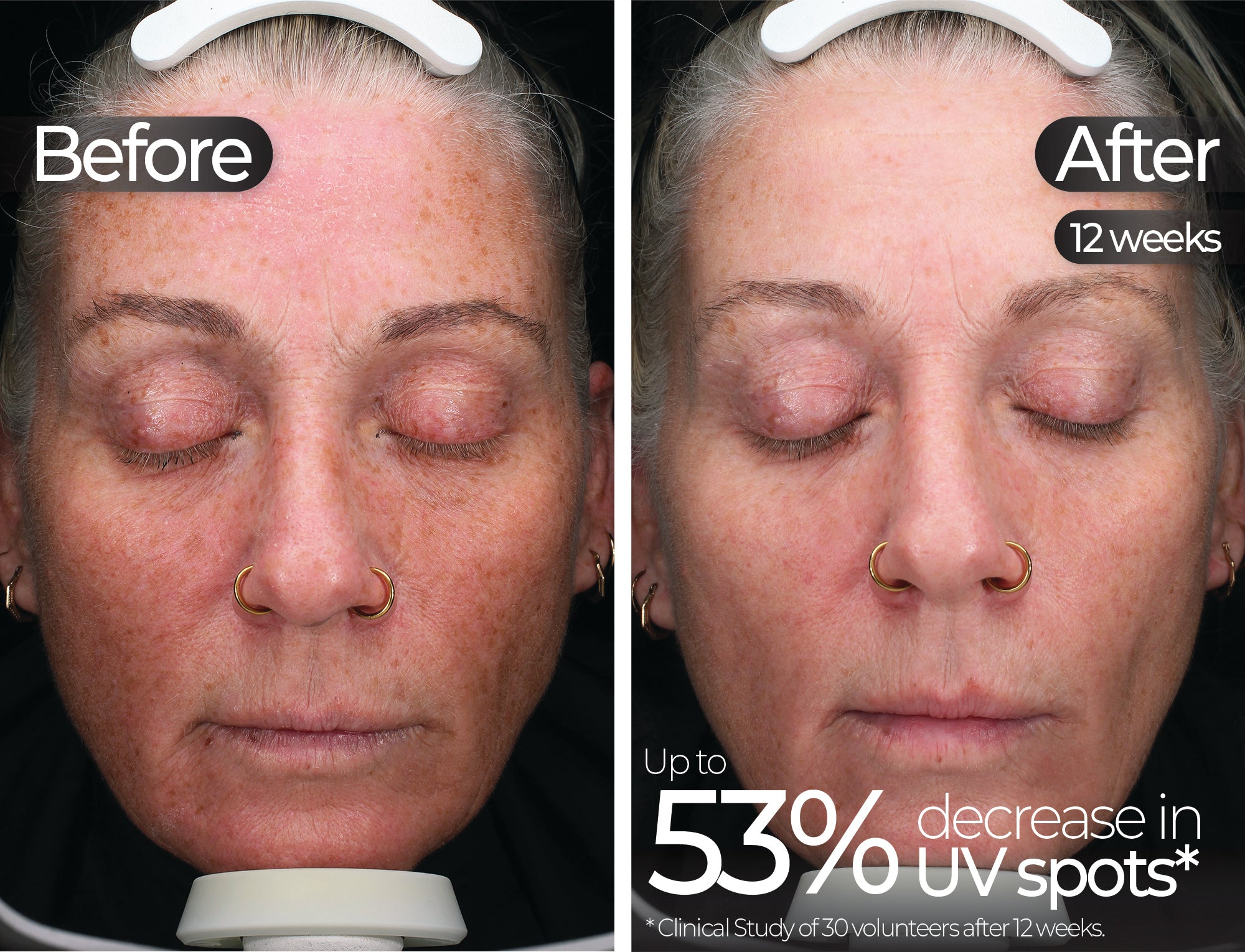 Before & After slide 1