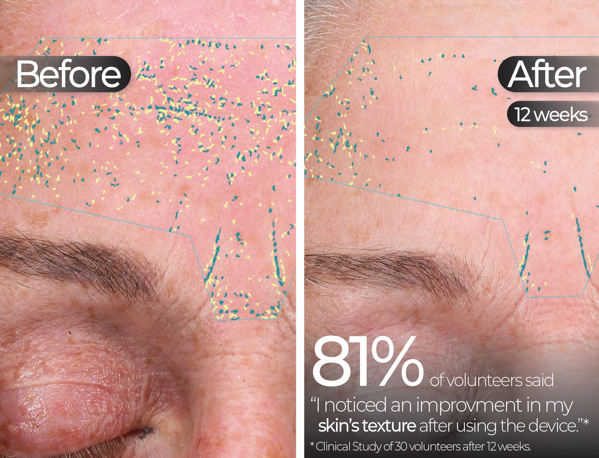 Before & After slide 8