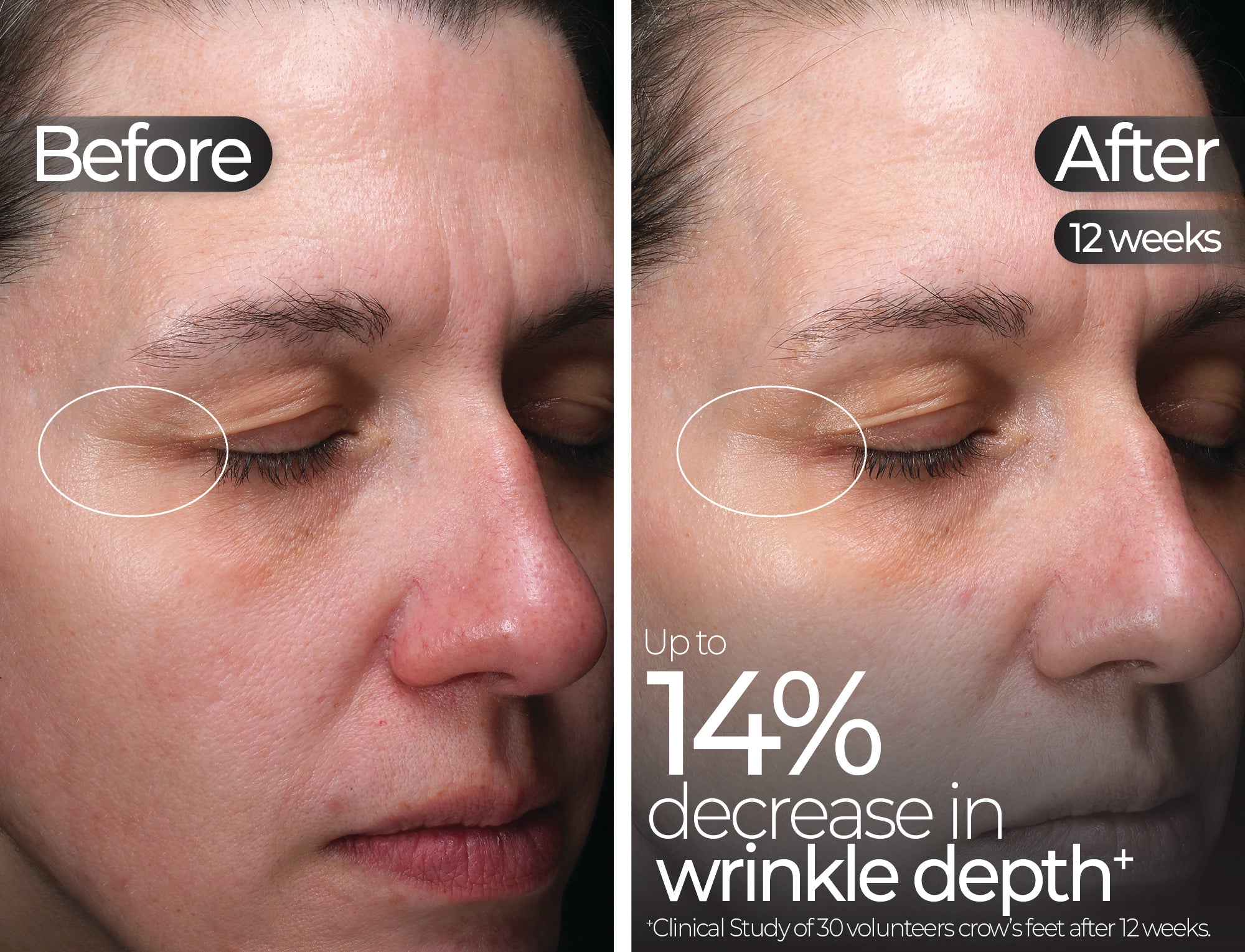 Before & After slide 9