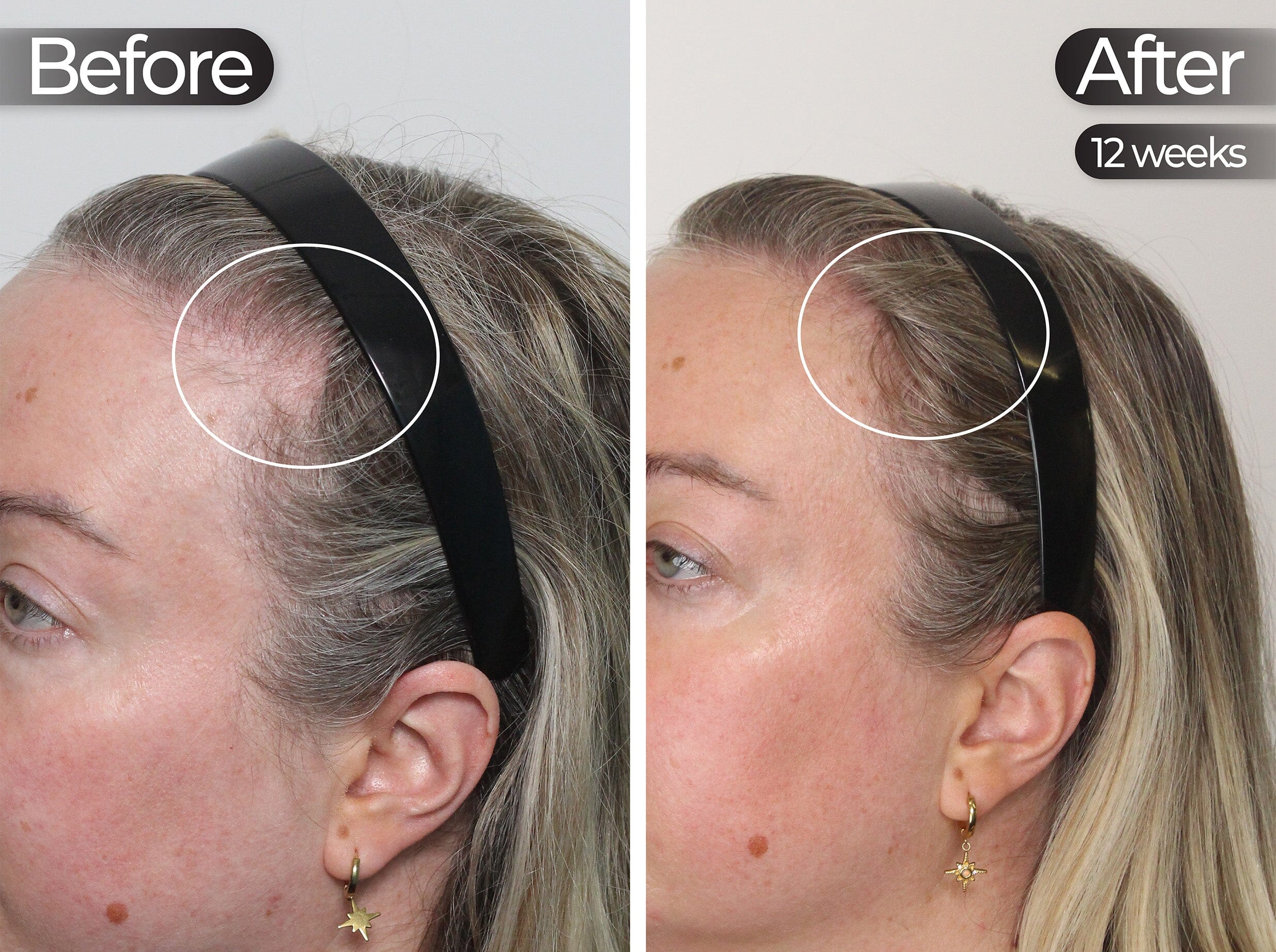 Before & After slide 1