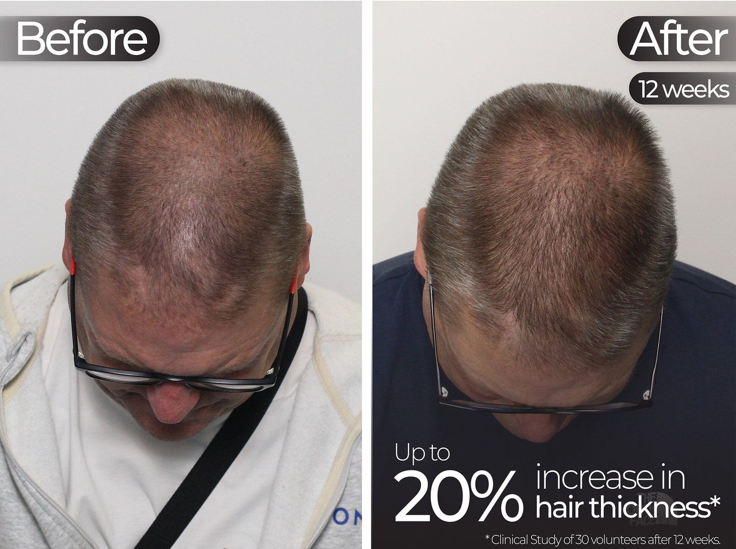 Professional Face Care Bundle