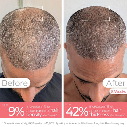 Root Renew Red Light Hairbrush